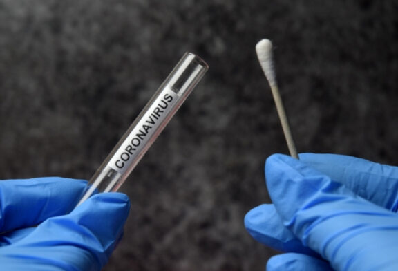 Free Community COVID-19 Testing Event to be Held in Jackson County